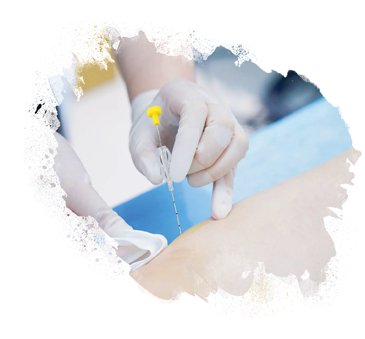 【埋线培训报名中······】《灵枢·颜》中医针美技术传承实战班 12月4日—6日 山东济南